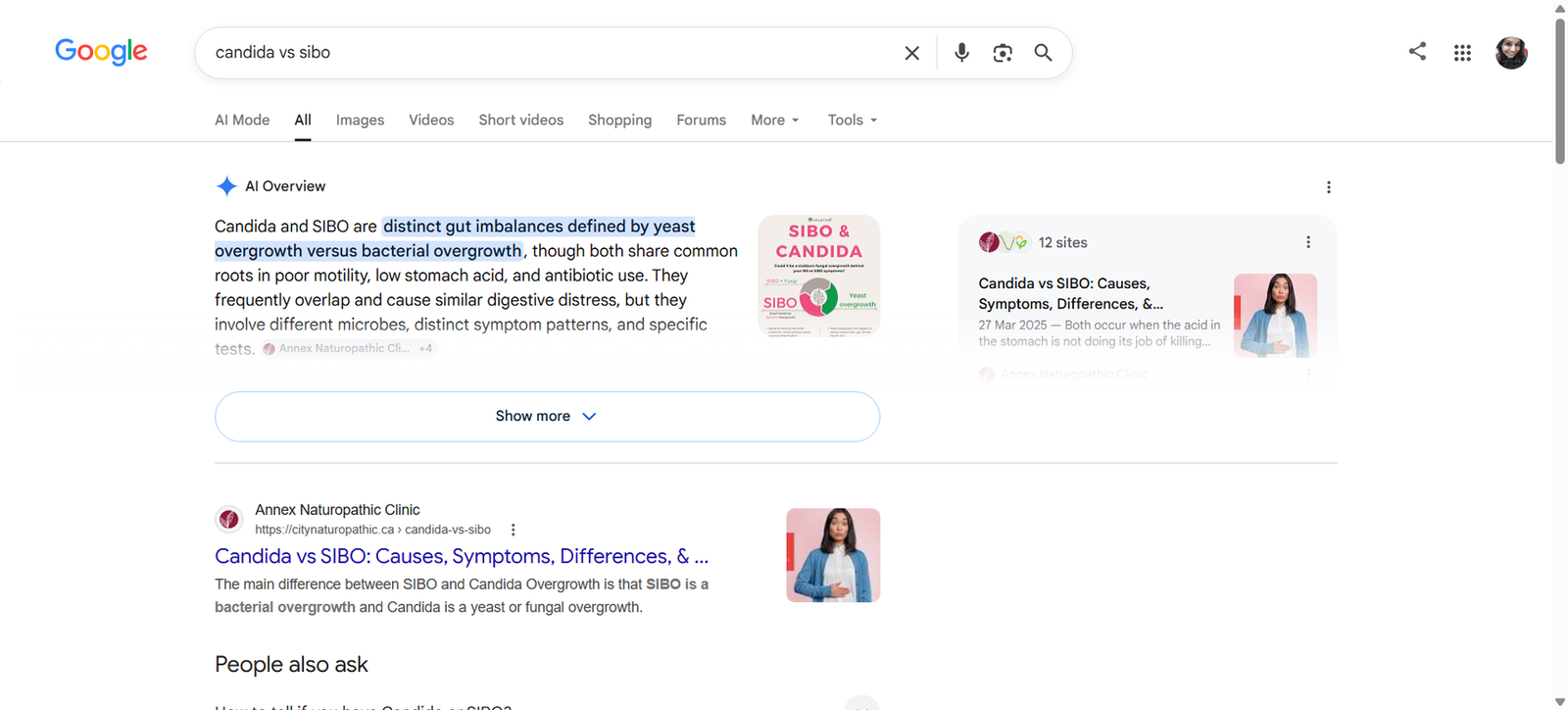 Google results page showing the Annex Naturopathic Clinic article in the AI Overview and first organic position for Candida vs SIBO